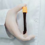 New blood test could spot kidney disease earlier and faster
