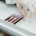 Simple blood test could strongly improve Alzheimer’s diagnosis and treatment