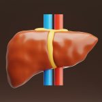 New hormone therapy may reverse fatty liver damage, study finds