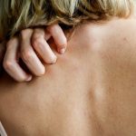 Can kidney disease cause itchy skin?