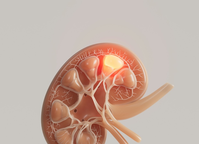 Sorry! Image not available at this time