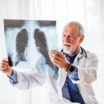 Study finds a surprising cause of early-stage lung cancer