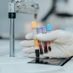 Simple midlife blood test may predict Alzheimer’s risk decades early