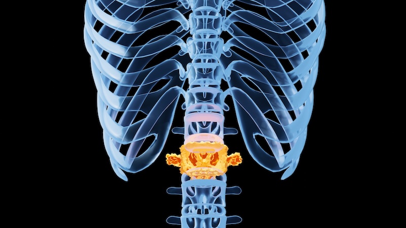 Sorry! Image not available at this time