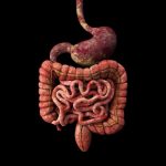 Scientists discover a new cause of colon cancer