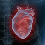 Heart fat linked to more severe damage after a heart attack