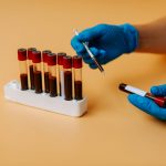 New test could help detect Alzheimer’s before symptoms appear