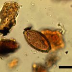 Not just cold and conflict: Roman troops at Hadrian’s Wall battled parasites