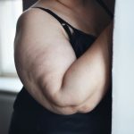 Obesity rapidly speeds up Alzheimer’s symptoms in the brain