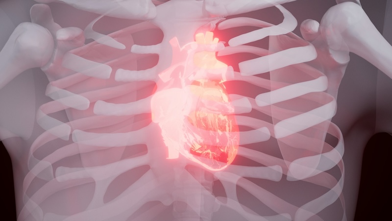 Sorry! Image not available at this time