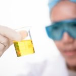 Urine test could detect bladder cancer non-invasively