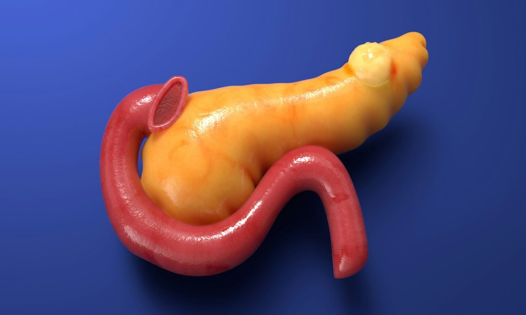 Sorry! Image not available at this time