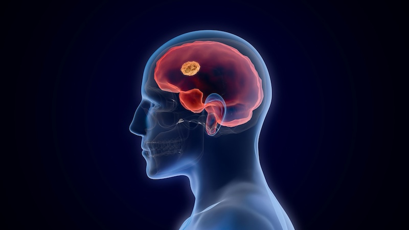 Sorry! Image not available at this time