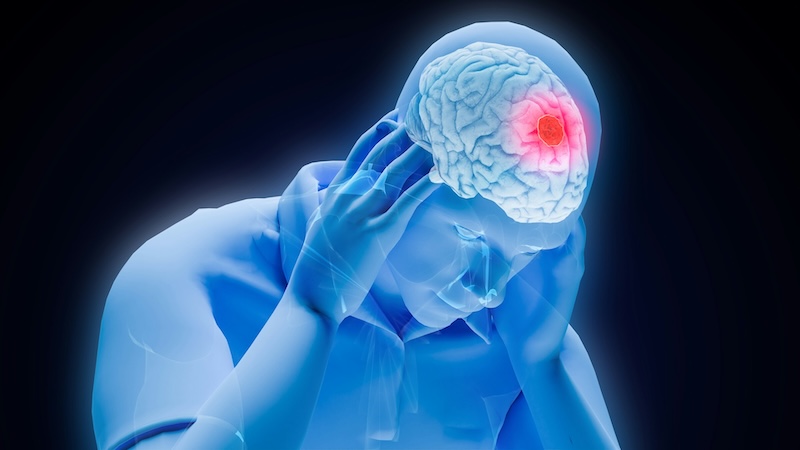 Sorry! Image not available at this time