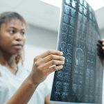 A mini-stroke could mean big trouble 10 years later, study finds