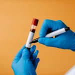New blood test could catch pancreatic cancer earlier