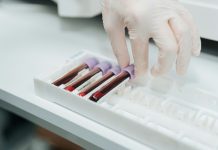 New rapid blood test could detect ALS with 97% accuracy