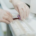 New blood test could help detect and treat Alzheimer’s earlier