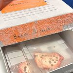 Scientists discover new clues to identify aggressive prostate cancer early