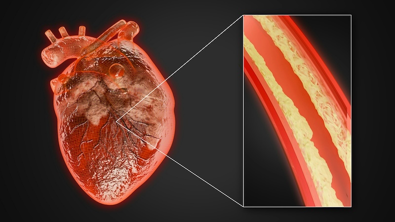 Sorry! Image not available at this time