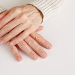 Treating arthritis of the hands