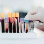 New blood test looks at protein shapes to detect Alzheimer’s earlier