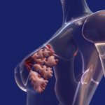 A simple blood test may predict breast cancer return years earlier