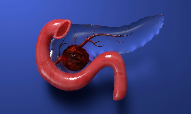 Sorry! Image not available at this time