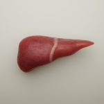 Scientists find a direct cause of fatty liver disease