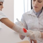 New drug-releasing stitches could change how wounds heal after surgery