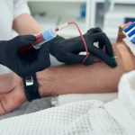 Starting dialysis early may not help older people with kidney disease
