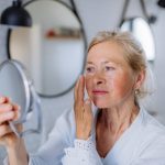 This eye disease is linked to Alzheimer’s, brain decline