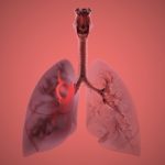 Combo therapy can make lung cancer treatment more effective