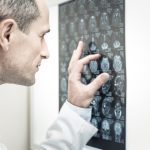 Big hidden brain cost of ultra-processed food