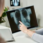 Scientists directly measure how smoking makes lungs stiffer and harder to breathe