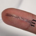 This stretchy implant could treat high blood pressure without drugs