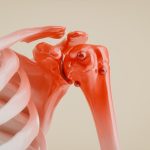 Hidden Bone Marrow Changes May Cause Dangerous Blood Cancers
