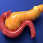 Scientists Discover What Helps Pancreatic Cancer Spread Through the Body