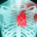 Common Blood Pressure Drug May Increase Risk of Sudden Cardiac Arrest