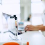 Could Gallstones Be an Early Clue to Pancreatic Cancer?