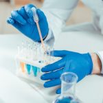 Scientists Find a Hidden Cause of Rheumatoid Arthritis in the Gut