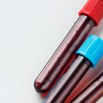 Cholesterol May Damage the Heart from the Inside