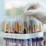 Gut Bacteria May Help Trigger Arthritis