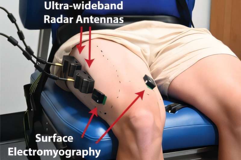 knowridge.com - University of Queensland - This Wearable Muscle Sensor Could Transform Rehabilitation and Robotic Mobility