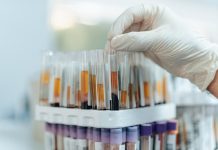 Blood Test May Help Guide Skin Cancer Treatment