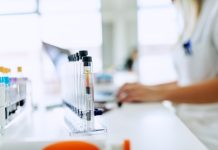 Tiny Number in Blood Test Could Show Spread of Prostate Cancer