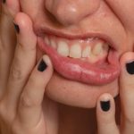 Omega-3 and Low-Dose Aspirin May Treat Severe Gum Disease