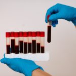 New Blood Test May Track Cancer in Real Time